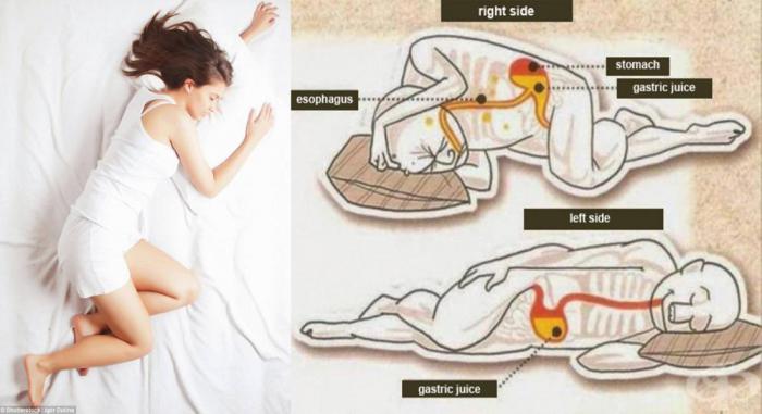 položaj tijela za vrijeme spavanja u hipertenzije